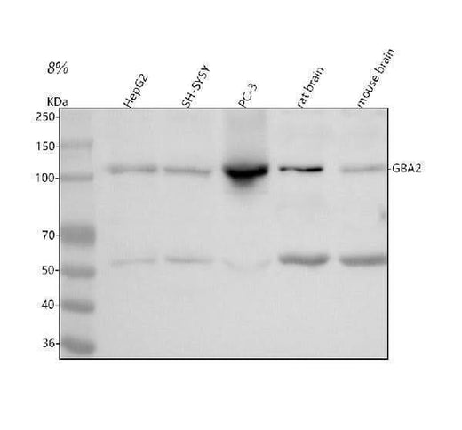 Anti-GBA2 Antibody Picoband® Boster Bio