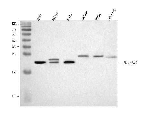 Anti-BLVRB Antibody Picoband® Boster Bio