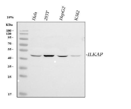 Anti-ILKAP Antibody Picoband® Boster Bio