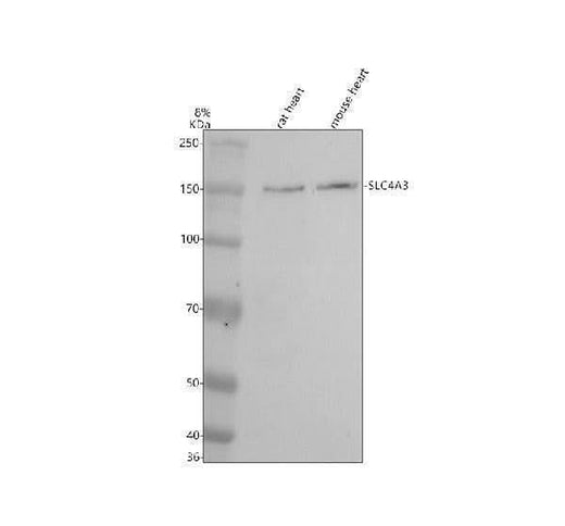Anti-SLC4A3 Antibody Picoband® Boster Bio