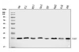 Anti-Proteasome 20S beta 7/PSMB7 Antibody Picoband® Boster Bio