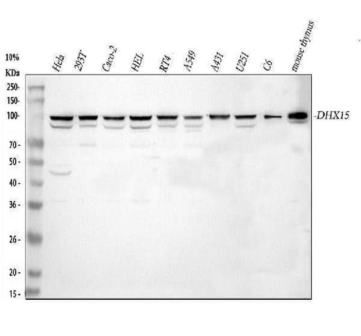 Anti-DHX15/prp43 Antibody Picoband® Boster Bio
