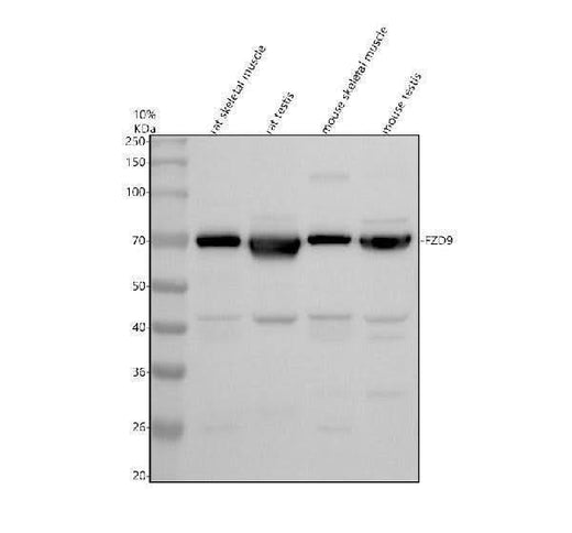 Anti-Frizzled 9/FZD9 Antibody Picoband® Boster Bio