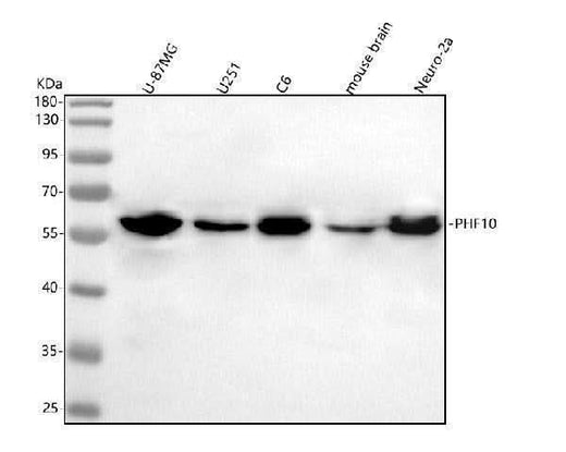 Anti-PHF10 Antibody Picoband® Boster Bio