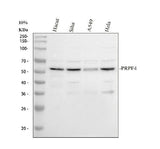 Anti-PRPF4 Antibody Picoband® Boster Bio