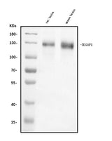 Anti-DLGAP1 Antibody Picoband® Boster Bio