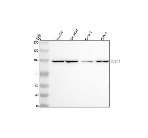 Anti-SUSD2 Antibody Picoband® Boster Bio