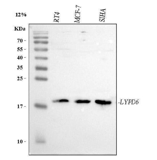 Anti-LYPD6 Antibody Picoband® Boster Bio