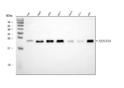 Anti-NDUFS8 Antibody Picoband® Boster Bio