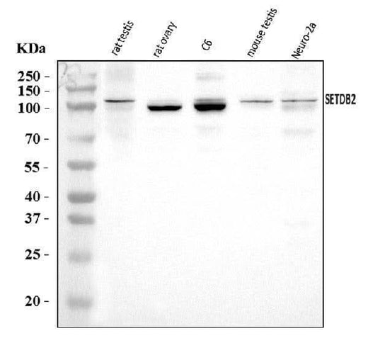 Anti-CLLD8/Setdb2 Antibody Picoband® Boster Bio
