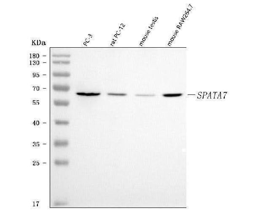 Anti-SPATA7 Antibody Picoband® Boster Bio