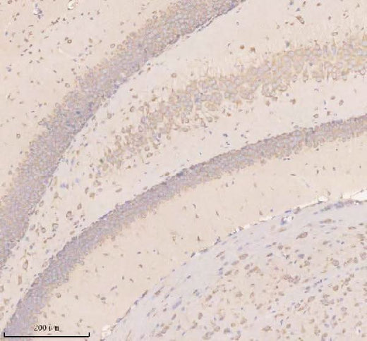 Anti-Neuronatin/NNAT Antibody Boster Bio