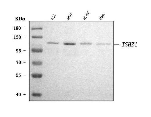 Anti-TSHZ1 Antibody Picoband® Boster Bio
