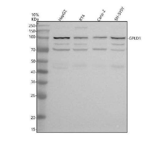 Anti-GPLD1 Antibody Picoband® Boster Bio