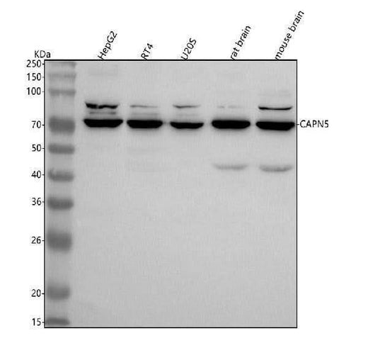 Anti-CAPN5 Antibody Picoband® Boster Bio