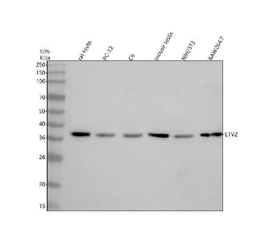 Anti-ETV2 Antibody Picoband® Boster Bio