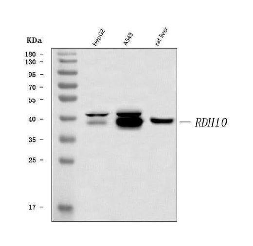 Anti-RDH10 Antibody Picoband® Boster Bio