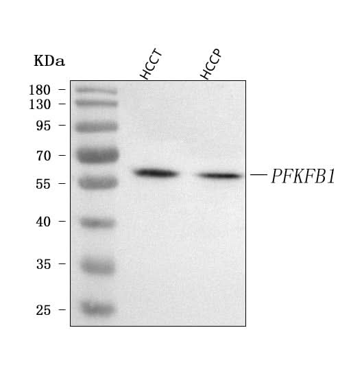 Anti-PFKFB1 Antibody Picoband® Boster Bio