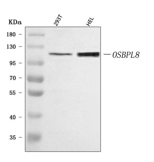 Anti-OSBPL8 Antibody Picoband® Boster Bio