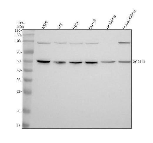 Anti-STEAP2 Antibody Picoband® Boster Bio