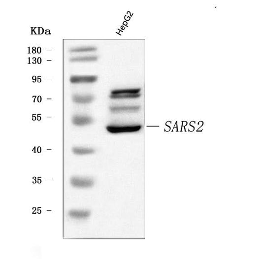 Anti-SARS2 Antibody Picoband® Boster Bio