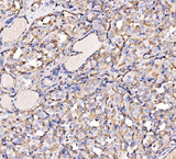 Anti-HECTD1 Antibody Picoband® Boster Bio