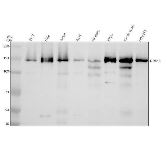 Anti-DDX46 Antibody Picoband® Boster Bio