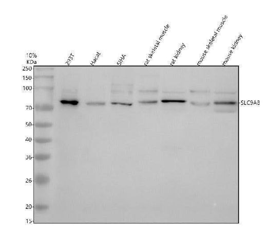 Anti-NHE8/SLC9A8 Antibody Picoband® Boster Bio