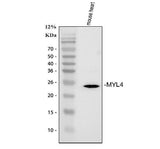 Anti-MYL4 Antibody Picoband® Boster Bio