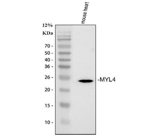 Anti-MYL4 Antibody Picoband® Boster Bio