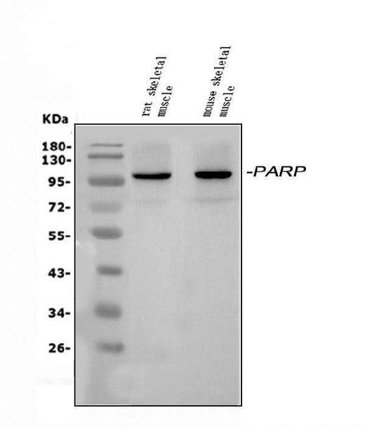 Anti-PARP9 Antibody Picoband® Boster Bio