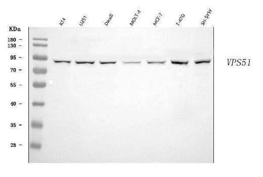 Anti-FFR/VPS51 Antibody Picoband® Boster Bio