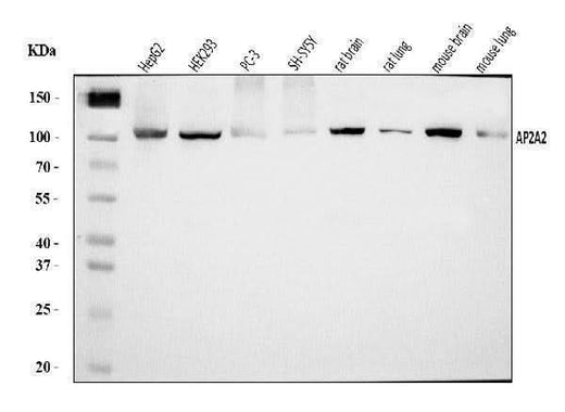 Anti-AP2A2 Antibody Picoband® Boster Bio