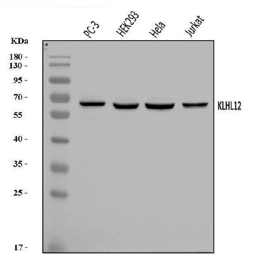 Anti-KLHL12 Antibody Picoband® Boster Bio