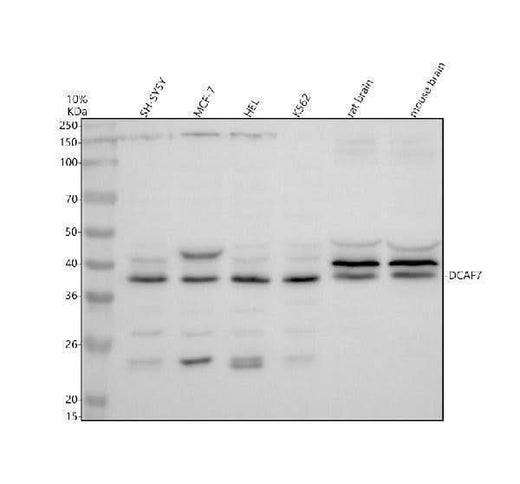 Anti-DCAF7 Antibody Picoband® Boster Bio