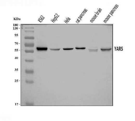Anti-YARS1 Antibody Picoband® Boster Bio