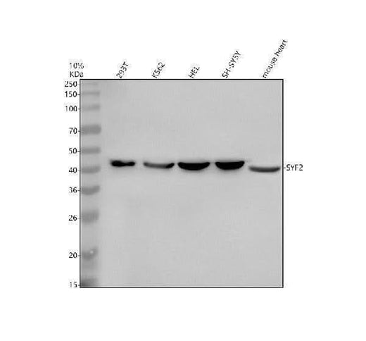 Anti-SYF2 Antibody Picoband® Boster Bio