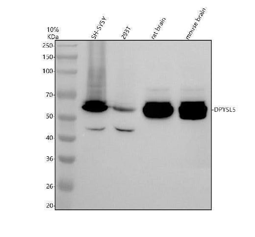 Anti-DPYSL5 Antibody Picoband® Boster Bio