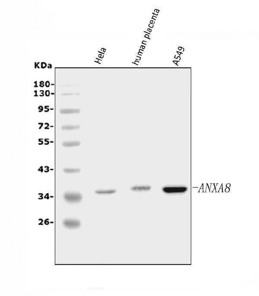 Anti-Annexin VIII/ANXA8 Antibody Picoband® Boster Bio