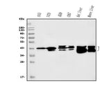 Anti-SBCAD/ACADSB Antibody Picoband® Boster Bio