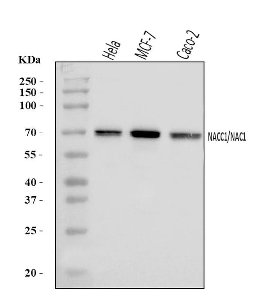 Anti-Nac1/NACC1 Antibody Picoband® Boster Bio