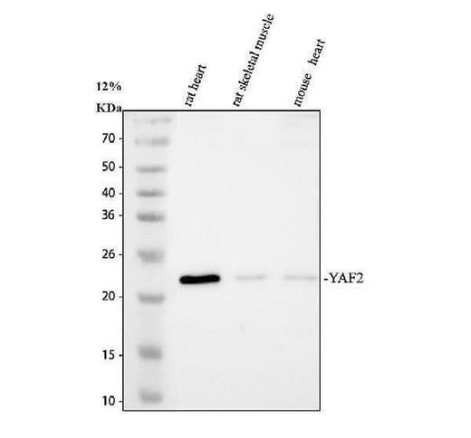 Anti-YAF2 Antibody Picoband® Boster Bio