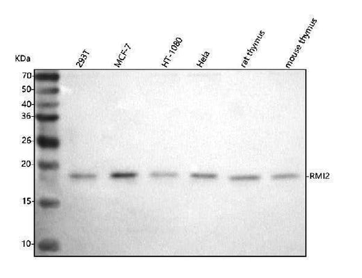 Anti-C16orf75/RMI2 Antibody Picoband® Boster Bio