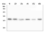 Anti-RMI2 Antibody Picoband® Boster Bio