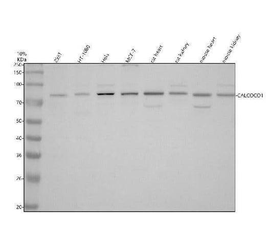 Anti-CALCOCO1 Antibody Picoband® Boster Bio