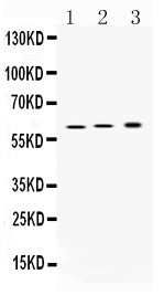 Anti-Hydrogen Potassium ATPase Beta/ATP4B Antibody Picoband® Boster Bio