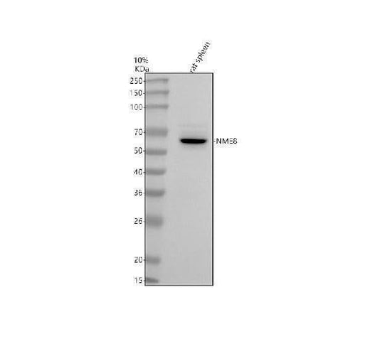 Anti-TXNDC3/NME8 Antibody Picoband® Boster Bio