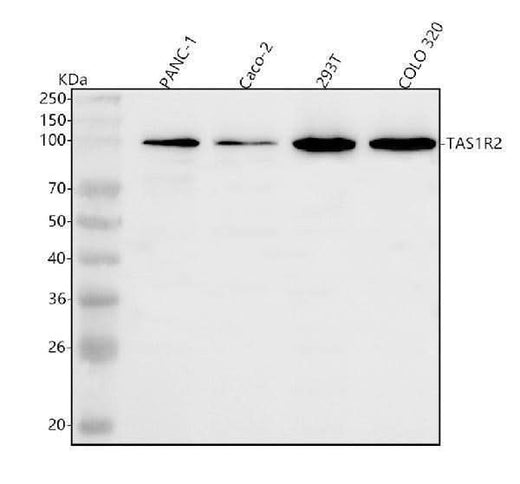 Anti-TAS1R2 Antibody Picoband® Boster Bio