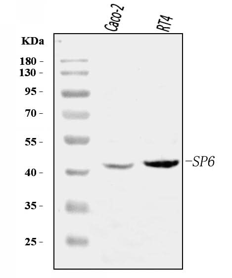 Anti-SP6 Antibody Picoband® Boster Bio