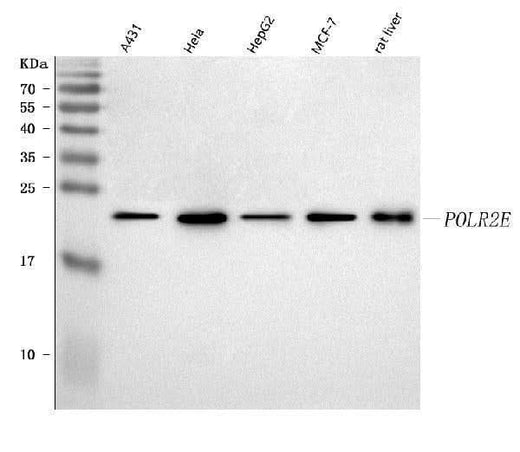 Anti-RPB5/POLR2E Antibody Picoband® Boster Bio
